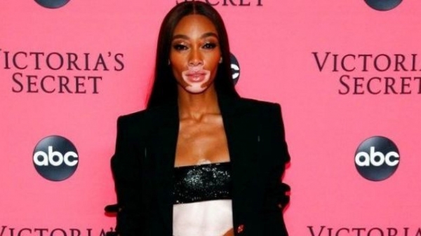 Winnie Harlow defends ‘America’s Next Top Model’ comments