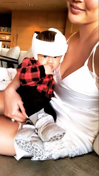 Chrissy Teigen reveals why baby son Miles needs corrective helmet